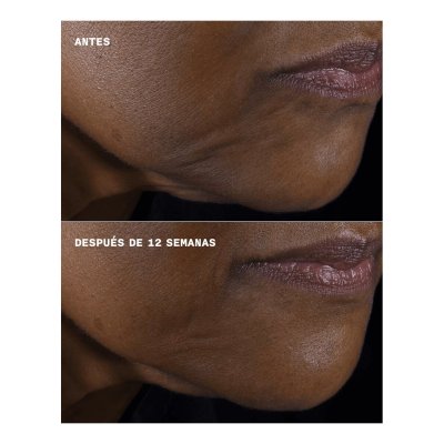 Smart Clinical Repair crema firmeza + lifting para rostro y cuello 50 ml