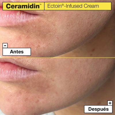 Ceramidin crema con ectoína 50 ml
